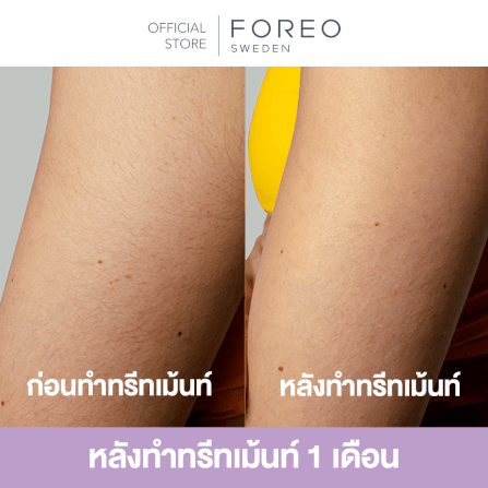 เครื่องกำจัดขน IPL FOREO PEACH 2 GO Peach_8